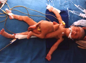 ��ͼ�����롰1ͷ2��4�ȡ�����Ӥ//