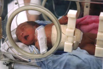 ��ͼ�����롰1ͷ2��4�ȡ�����Ӥ//