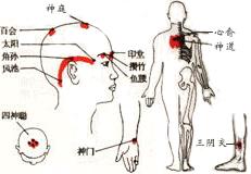 ʧ�ߵĹ����Ʒ�(����ͼƬ)