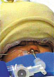 ͷ������Ӥ���������������ɹ�