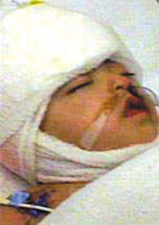 ͷ������Ӥ���������������ɹ�