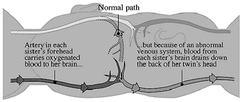 ͷ������Ӥ���������������ɹ�