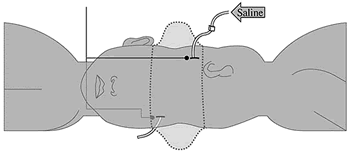 ͷ������Ӥ���������������ɹ�