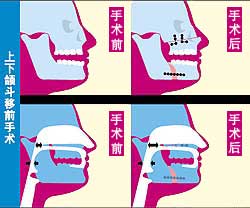 ����򢶷��ǰ����