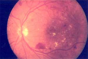 ����Ĥ����