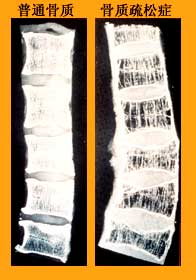 ��������֢X��Ƭ