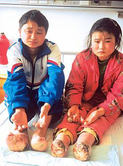 ���ͬ���ֲ� ��ָ��ֺ�ڽ�������ʧ