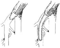΢����������������������֢��֫ȱѪ//