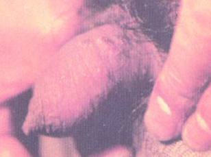 ��ֳ������1//