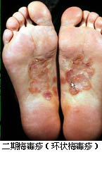 ����÷����(��״÷����)//