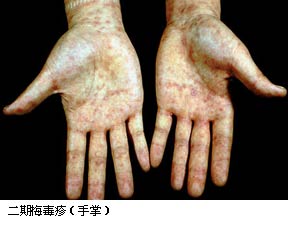 ����÷����(����)//