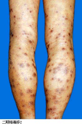 ����÷����2//