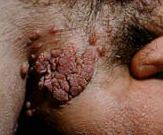 ����ʪ��4//