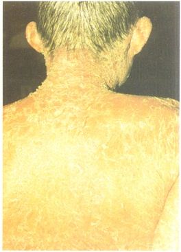 ������Ƥ����ҩ��//