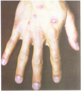 ˮ�弰�����Ͷ��κ��//