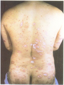 Ѱ������м���ȶ���//