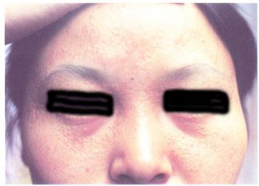 ������//