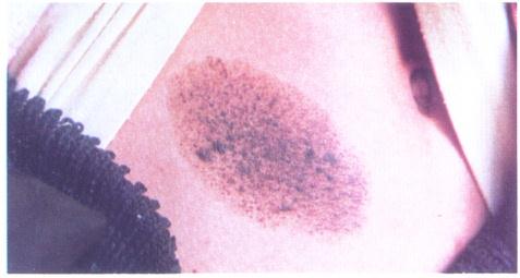 ��ϸ����1//