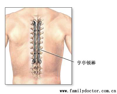 ׵���ۺϽ����˼���������ԣ�Ҫ���������������������߻ָ�����������ԡ�