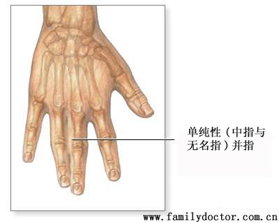 ָ()ָ,ֵķ쳣ָȡл޹ͷָ׵书ܻӰʱӦʩ