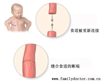 ϶ˡͨ״ܲֽ׶νУθſθֹθҺβػĻֱתԳг޸ʳ