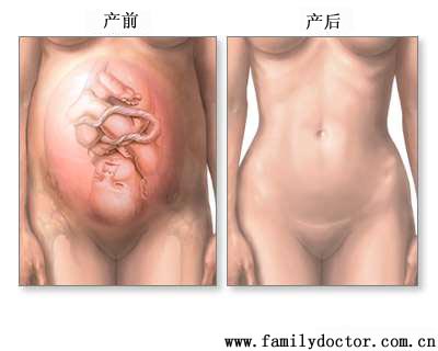 �����������Ӥ������������á��������Ļָ�����Ȼ����������ʱ���Գ���ƽ����Ժʱ��2~4�졣�����켴�������������Լ��ٻָ����ɿڷ�ֹʹҩֹʹ��