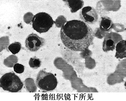 ȫ���ܰͽἰ��Ƣ�״������򵰰����ߣ��������߲��������ܰ��������¡�������򵰰�Ѫ֢��