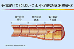 ����LDL-G�ǽ�֬���Ʒ��ι��Ĳ�����ҪĿ��ڶ���Ѫ֬�쳣ѧ�����ֻᡪ����ǰ�Ἧ��