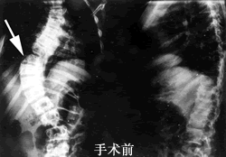 �����Ρ���ͦ������