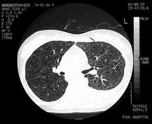 ���ء������ء�˫�������Բ���