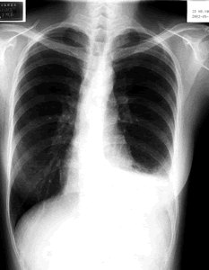 ���ء������ء�˫�������Բ���