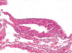 ���ء������ء�˫�������Բ���