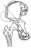 ����������λ