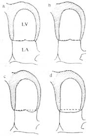 ������Ѵ��ۺ���