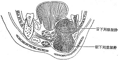 ��¼�϶��Ⱦ