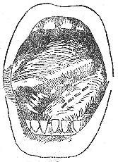 ���¼�϶��Ⱦ