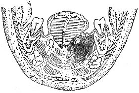 ���¼�϶��Ⱦ