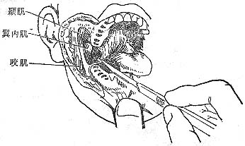 ���Լ�϶��Ⱦ