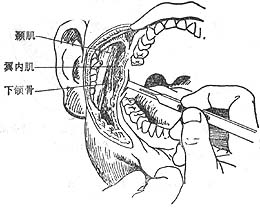 ������϶��Ⱦ