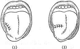 ��ǻ��沿����֯����