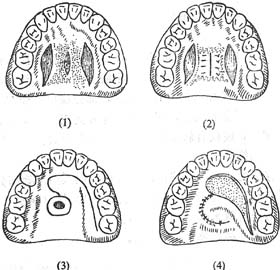 ��ǻ��沿����֯����