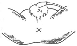 ���ű���