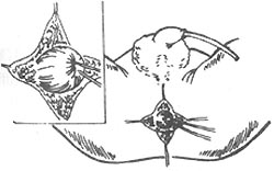 ���ű���