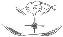 ���ű���