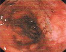 ��֫����ʹ����ʹ����Ѫ