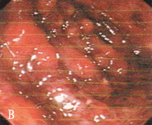 ��֫����ʹ����ʹ����Ѫ