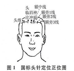 ǳ����ͷ��Ѩ�����ʱ�׼���������Ŀ�ѧ��