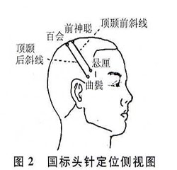 ǳ����ͷ��Ѩ�����ʱ�׼���������Ŀ�ѧ��