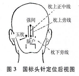 ǳ����ͷ��Ѩ�����ʱ�׼���������Ŀ�ѧ��