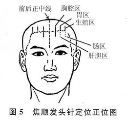 ǳ����ͷ��Ѩ�����ʱ�׼���������Ŀ�ѧ��